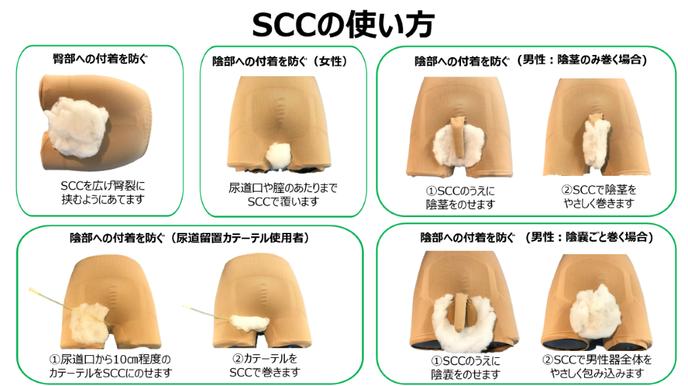 SCCの具体的な使い方図解