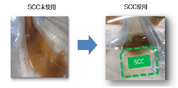 SCC使用・未使用の比較
