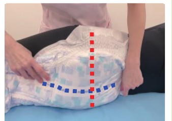 STEP3 側臥位でセンターラインを合わせる